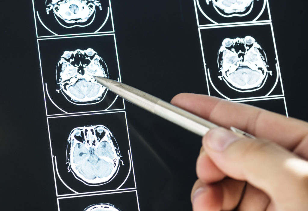 DOCTOR VIEWING A BRAIN XRAY